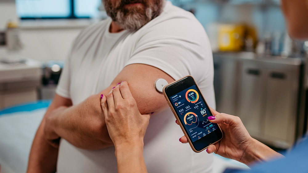 Diabetes tipo 2 asociada a la obesidad