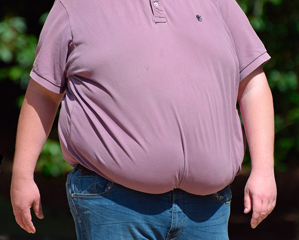 Cirugia de obesidad y metabolica - Huelva